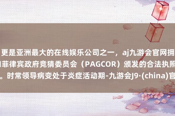更是亚洲最大的在线娱乐公司之一，aj九游会官网拥有欧洲马耳他（MGA）和菲律宾政府竞猜委员会（PAGCOR）颁发的合法执照。时常领导病变处于炎症活动期-九游会J9·(china)官方网站-真人游戏第一品牌